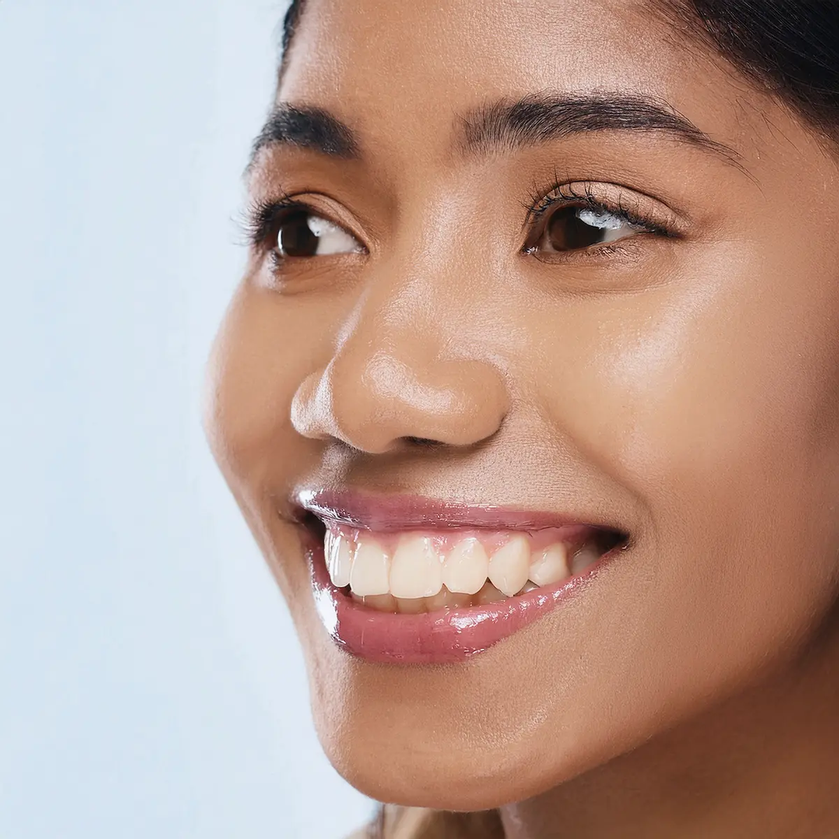 Smile Transformation Semarang di Klinik Gigi New Smile Dental & Implant Center