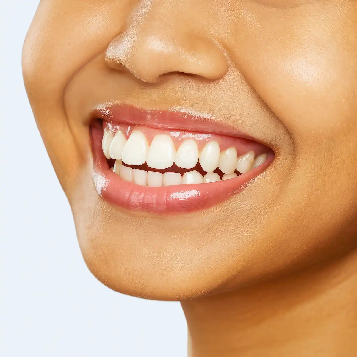 Senyum Sempurna Bersama Klinik Gigi Semarang - New Smile Dental & Implant Center