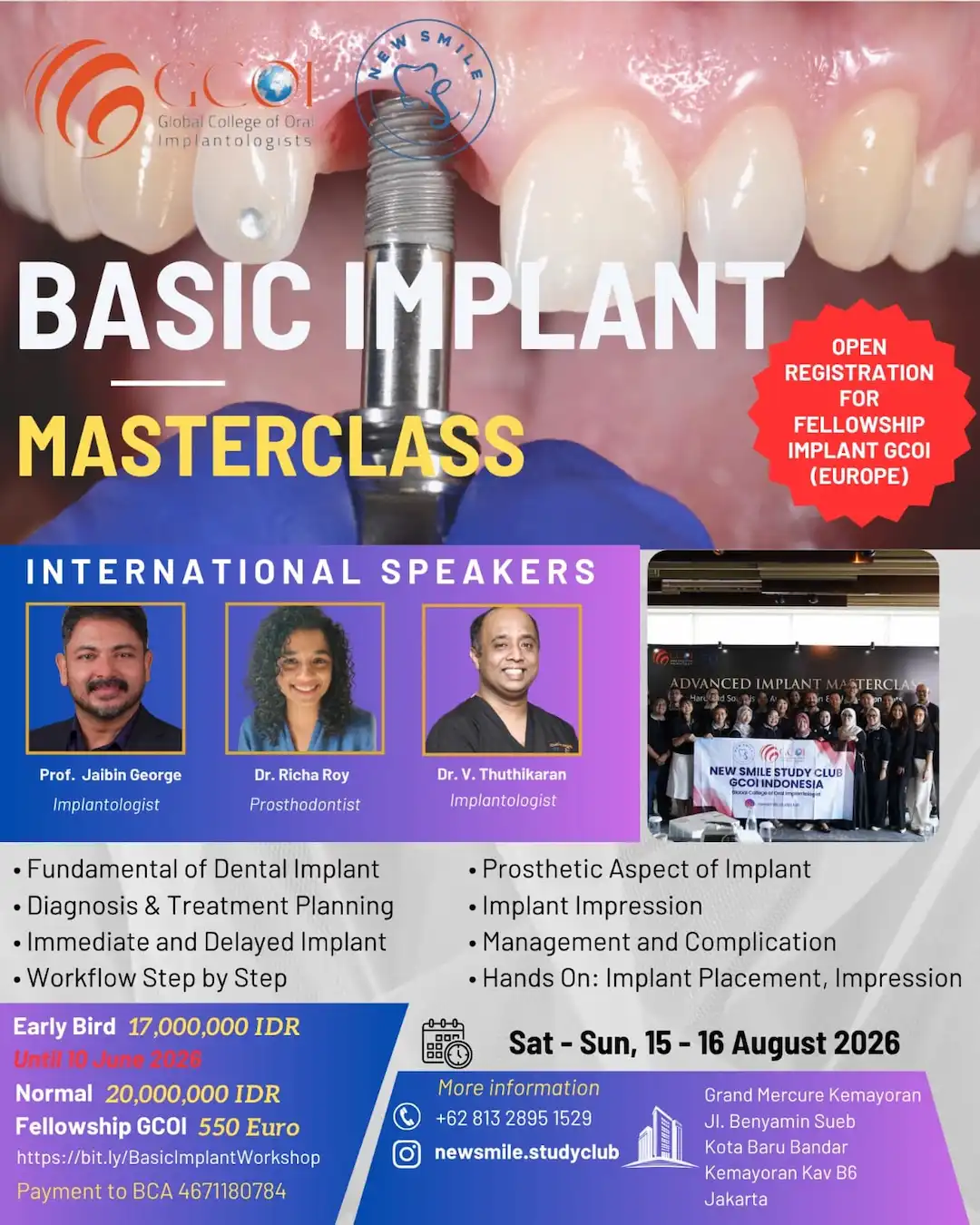 Basic Implant Masterclass 15-16 Agustus 2026